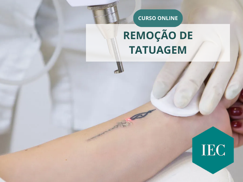 REMOÇÃO DE TATUAGEM LASER